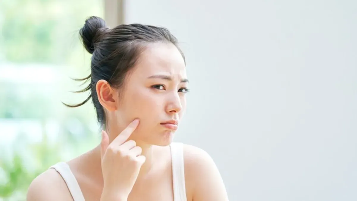 Sunscreen bukan sekadar skincare, tapi investasi untuk kesehatan kulitmu. (Sumber: Shutterstock)