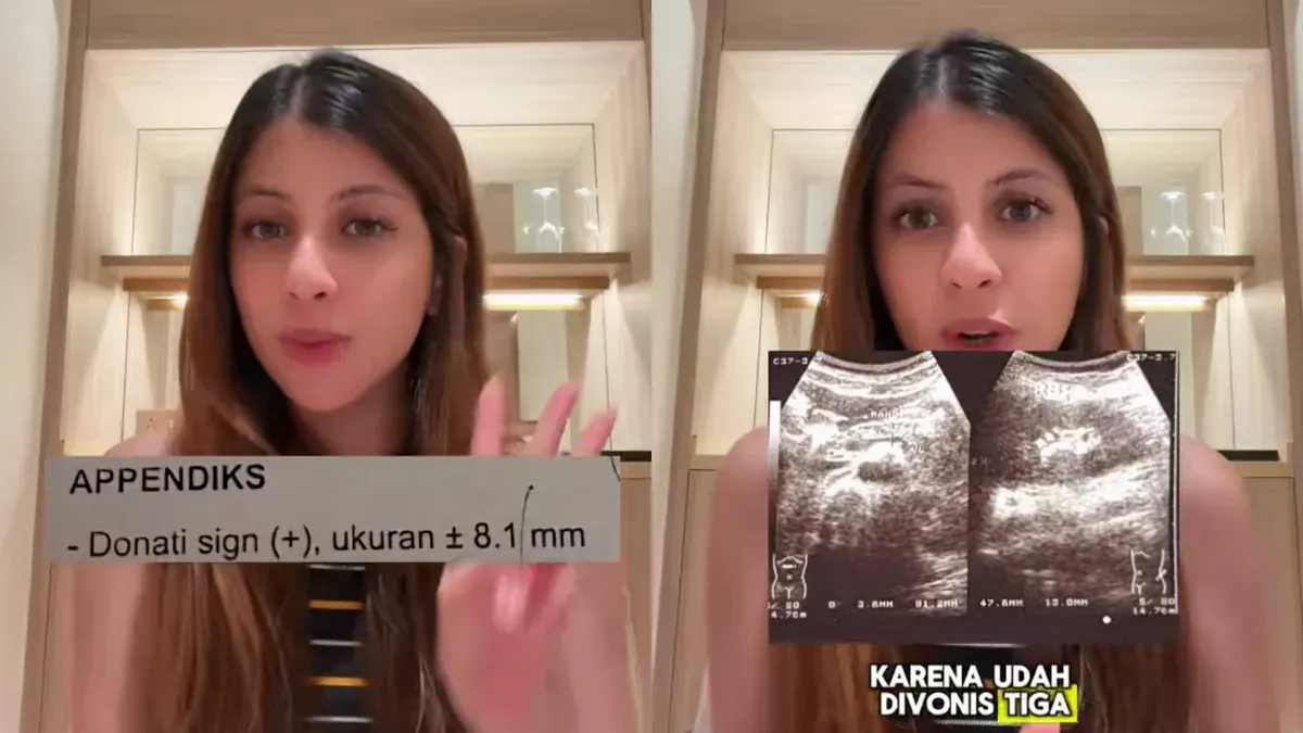 Tiktoker Fahira Mira meminta maaf setelah dituding melakukan blac campaign dengan menyebut salah mendapatkan diagnosa di tiga rumah sakit berbeda di Indonesia. (Sumber: TikTok/@fahiramira)