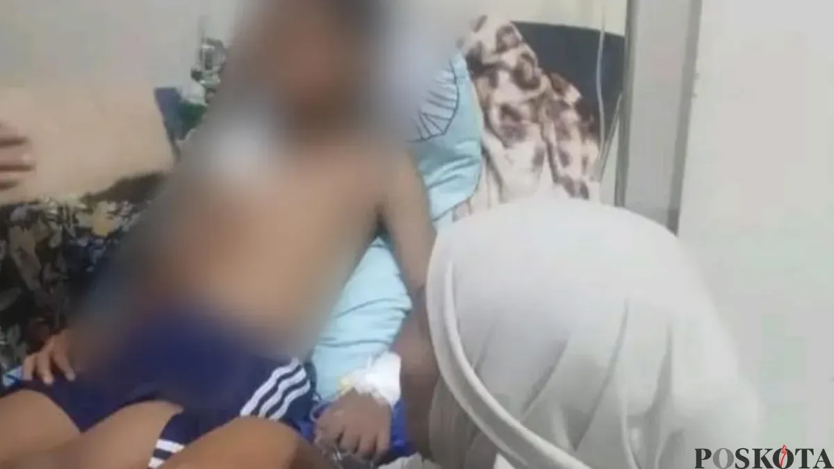 Korban serangan buaya saat menjalani perawatan di Puskesmas Sumur, Pandeglang. (Sumber: Pos Kota/ Samsul Fatoni)