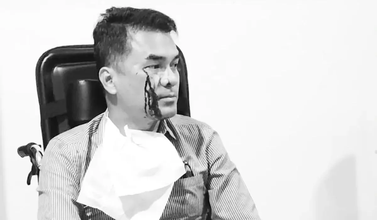 Ronald Aristone Sinaga atau yang akrab disapa Bro Ron tengah menjadi sorotan usai dirinya menjadi korban dugaan penganiayaan di kawasan Menteng, Jakarta Pusat. (Sumber: Instagram/@brorondm)