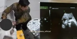 Pasien berinisial F membongkar kelakuan dokter kandungan di Garut yang melakukan pelecehaan saat pemeriksaan USG. (Sumber: Instagram/@nyinyir_update_official)