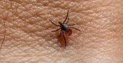 Cara sederhana basmi tungau di kasur. (Sumber: Pexels/Erik Karits)