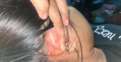 HK mengalami luka di beberapa bagian tubuhnya yang disebabkan oleh IAP. Ia tidak terima jika ditetapkan sebagai tersangka dan mengaku tak kuat membayar uang damai. (Sumber: Poskota/Nurpini Aulia Rapika)