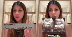 Tiktoker Fahira Mira meminta maaf setelah dituding melakukan blac campaign dengan menyebut salah mendapatkan diagnosa di tiga rumah sakit berbeda di Indonesia. (Sumber: TikTok/@fahiramira)