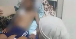 Korban serangan buaya saat menjalani perawatan di Puskesmas Sumur, Pandeglang. (Sumber: Pos Kota/ Samsul Fatoni)