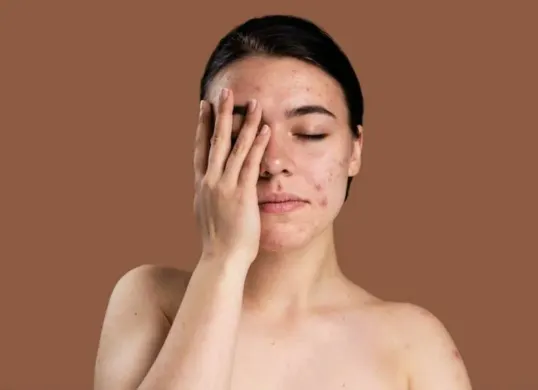 Simak panduan lengkap merawat kulit wajah sensitif agar tetap sehat dan bebas iritasi. (Sumber: Pinterest/sahrul ddv)