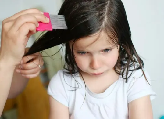 Coba cara membasmi kutu rambut hingga telurnya dengan metode alami. (Sumber: Pinterest/Rustica)