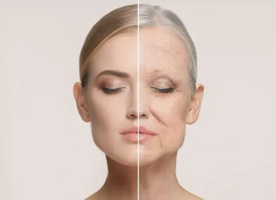 Tips alami hilangkan keriput dan garis halus di wajah. (Sumber: Pinterest)
