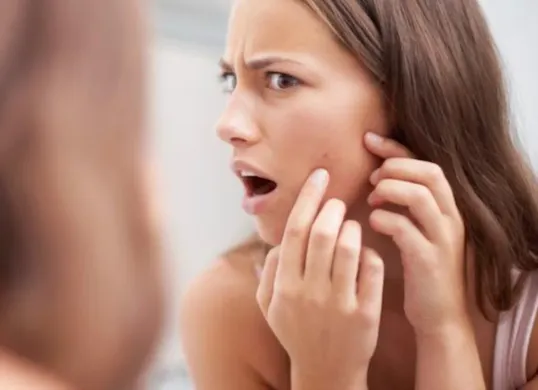 Simak cara efektif menghilangkan jerawat batu dengan mudah di rumah. (Sumber: Pinterest/StyleCaster)