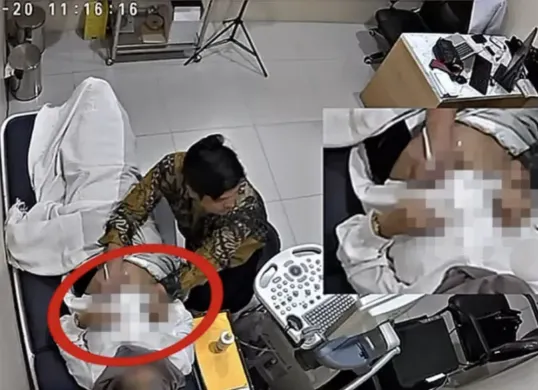 Tangkapan layar rekaman CCTV yang diduga memperlihatkan tindakan tidak etis oleh seorang dokter kandungan di Garut, viral di media sosial (Sumber: Instagram/@drg.mirza)