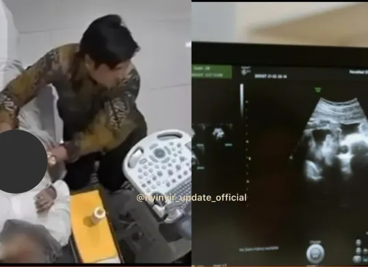 Pasien berinisial F membongkar kelakuan dokter kandungan di Garut yang melakukan pelecehaan saat pemeriksaan USG. (Sumber: Instagram/@nyinyir_update_official)