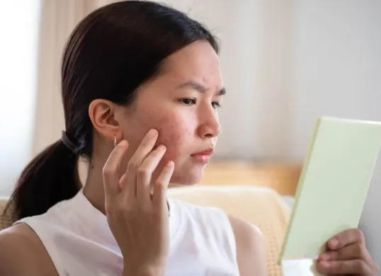 Simak cara hilangkan bopeng bekas jerawat dengan cara alami. (Sumber: Pinterest/The Independent)