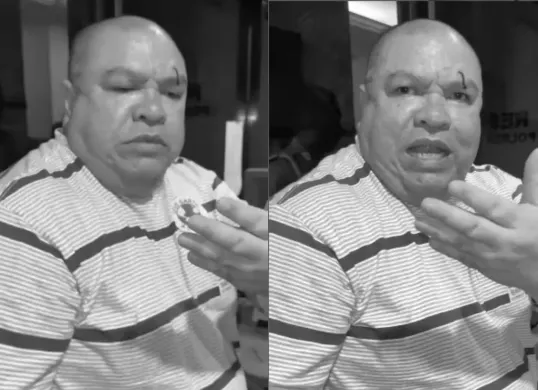 Razman Arif Nasution mengaku dipukul oleh Nikita Mirzani di Polres Metro Jakarta Selatan. (Sumber: Tangkap Layar Instagram/@razmannasution71)