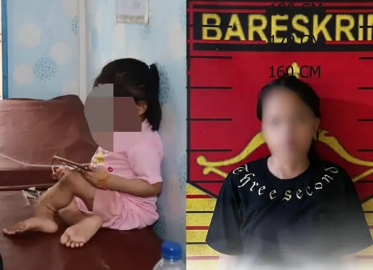 Tante bocah yang diduga dianiaya keluarga hingga kedua kaki patah di Nias Sekatan ditetapkan sebagai tersangka. (Sumber: Instagram/@polres.nias.selatan)