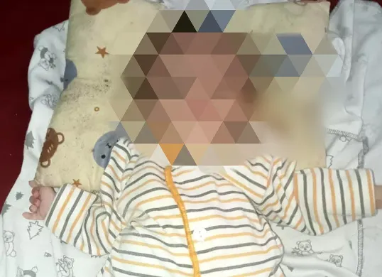 Bayi yang diduga alami gizi buruk di Kampung Pade, Kecamatan Cipeucang, Pandeglang. (Sumber: Dokumen Warga)