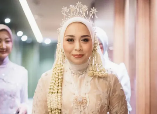 Sosok Putri Karlina, Waki Bupati Garut yang kini menjadi menantu Gubernur Jawa Barat Dedi Mulyadi. (Sumber: Instagram/@putri.karlina14)