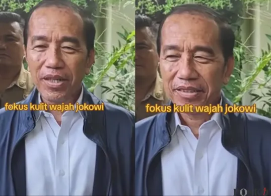 Kesehatan Jokowi jadi sorotan (Sumber: TikTok/negeriku_62)