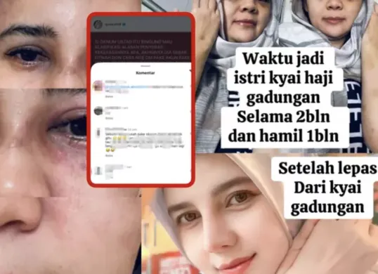 Suila Rohill membagikan foto kondisi lebam usai dugaan kekerasan, memicu simpati dan kemarahan netizen. Nama Ustadz Zaky Mubarok ikut terseret sebagai mantan suami dan terduga pelaku. (Sumber: Instagram/@suilarohill)