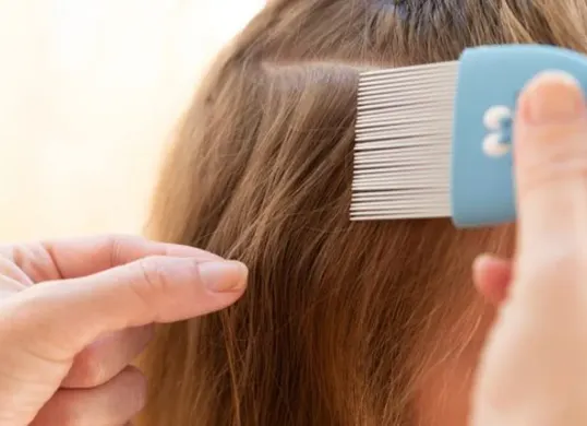 Kebiasaan ini bisa jadi penyebab kutu rambut bersarang di kepalamu. (Sumber: Pinterest/Astuce du Jour)