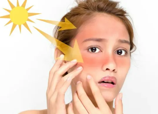 Simak cara memakai sunscreen yang benar agar wajah tidak terlihat kusam. (Sumber: Pinterest/Stacy Geisinger)