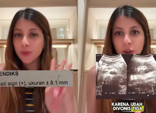 Tiktoker Fahira Mira meminta maaf setelah dituding melakukan blac campaign dengan menyebut salah mendapatkan diagnosa di tiga rumah sakit berbeda di Indonesia. (Sumber: TikTok/@fahiramira)