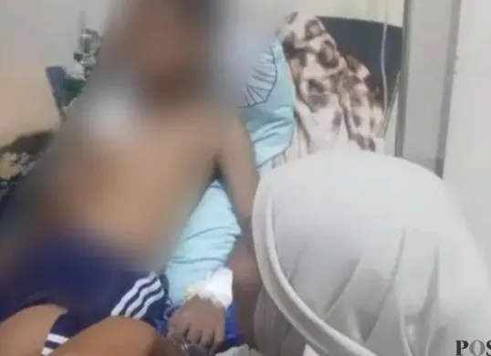 Korban serangan buaya saat menjalani perawatan di Puskesmas Sumur, Pandeglang. (Sumber: Pos Kota/ Samsul Fatoni)