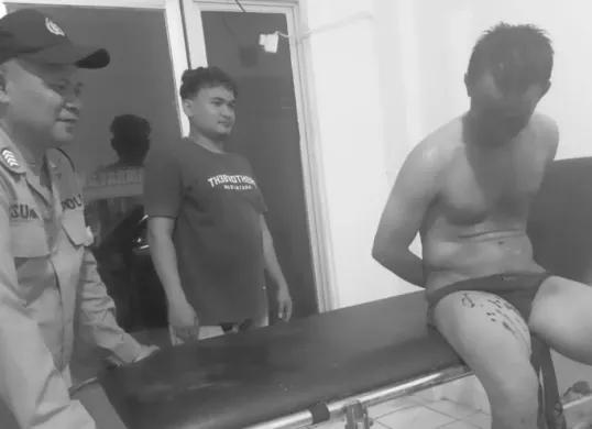 Pelaku percobaan pencurian toko swalayan Indomaret saat mendapat perawatan di puskesmas. (Sumber: Polsek Cikande)